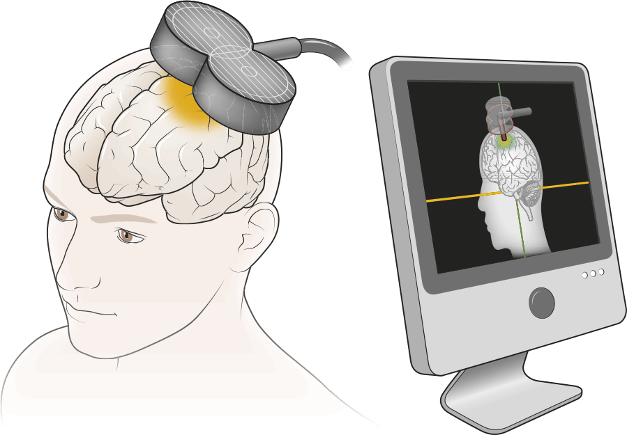 Глубокая стимуляция мозга. Живой мозг Дэвид Иглмен. Иглмен мозг ваша личная история. Аудио стимуляция мозга.